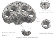 3D ACT ABM - acetabular rekonstruksjons system