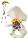 3D ACT-ABM Optec  DR_v2-0222 (1)9