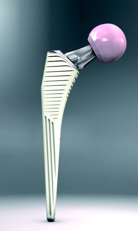 3HYDRA-BROCHURE-AND-SURG-TEC-ENG-1 (1)
