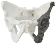 3D printede acetabular komponenter