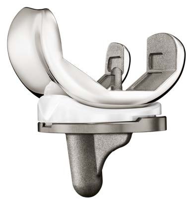 ORIGIN CR Knee System presentation_MKT.PRES0008V1.05
