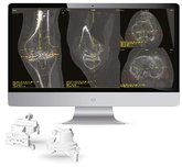 ORIGIN CR Knee System presentation_MKT.PRES0008V1.06